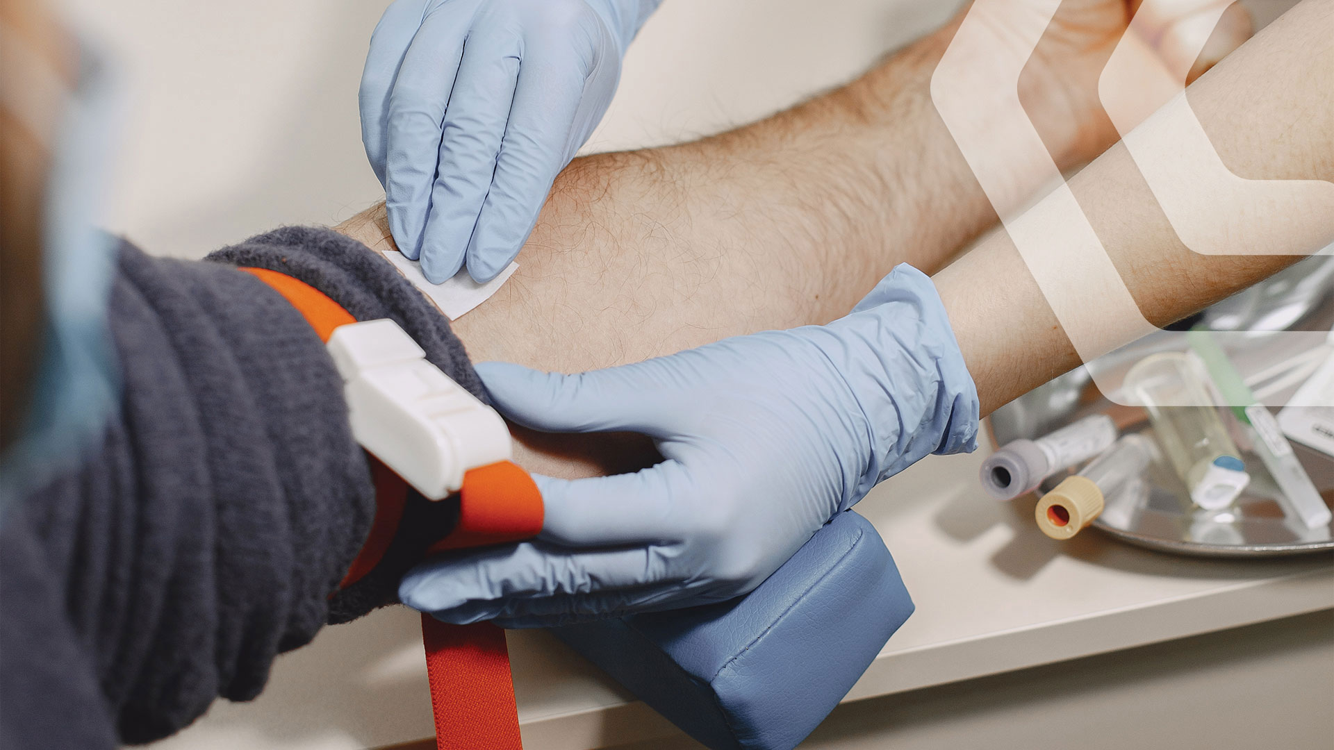 რა არის ვენური უკმარისობის სიმპტომები და სტადიები?