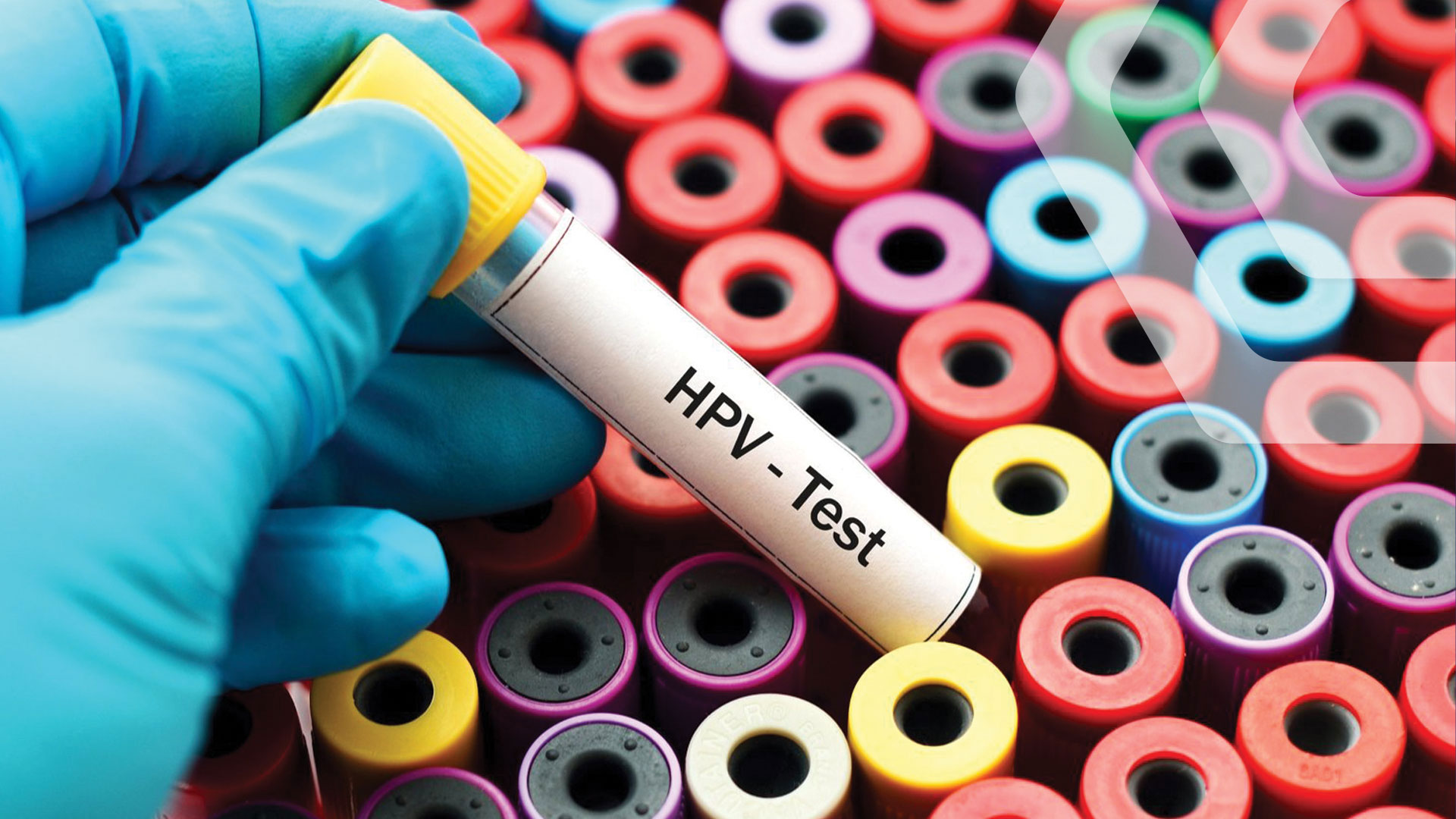 Pap Test