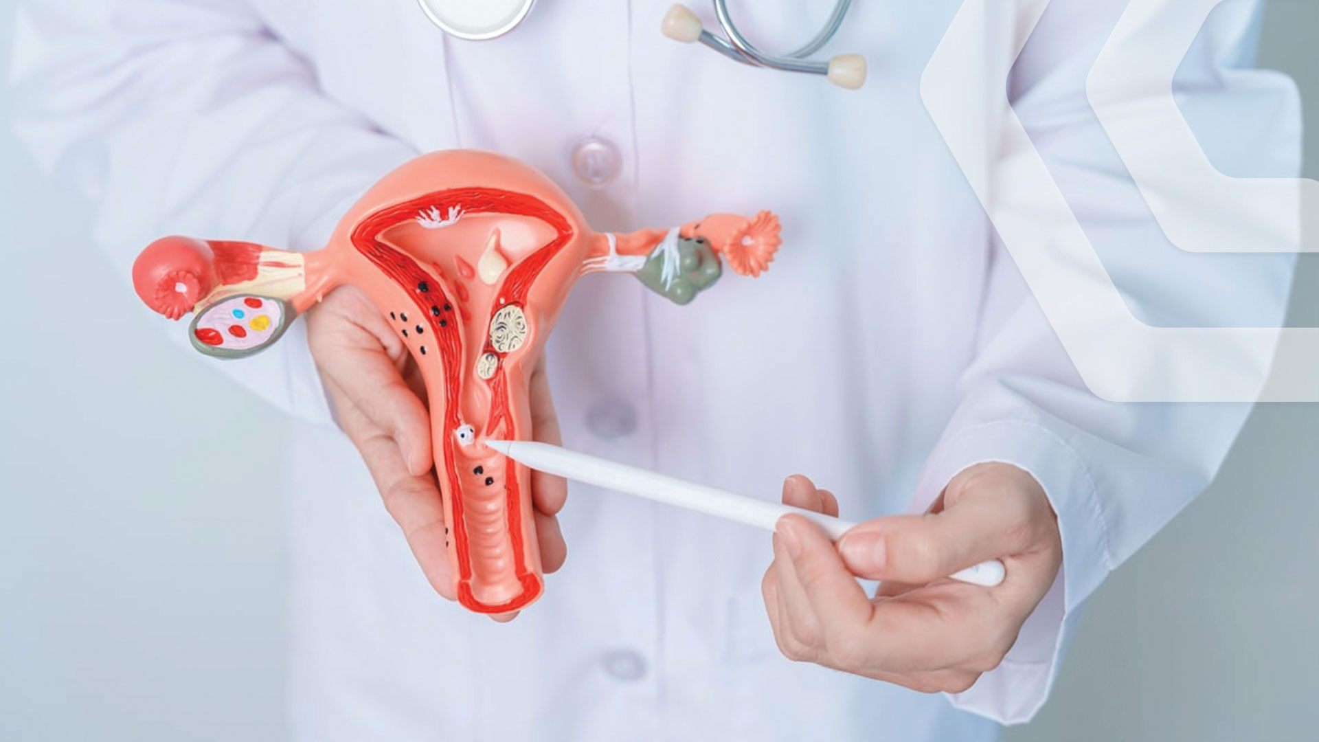 გენიტალური სოკო