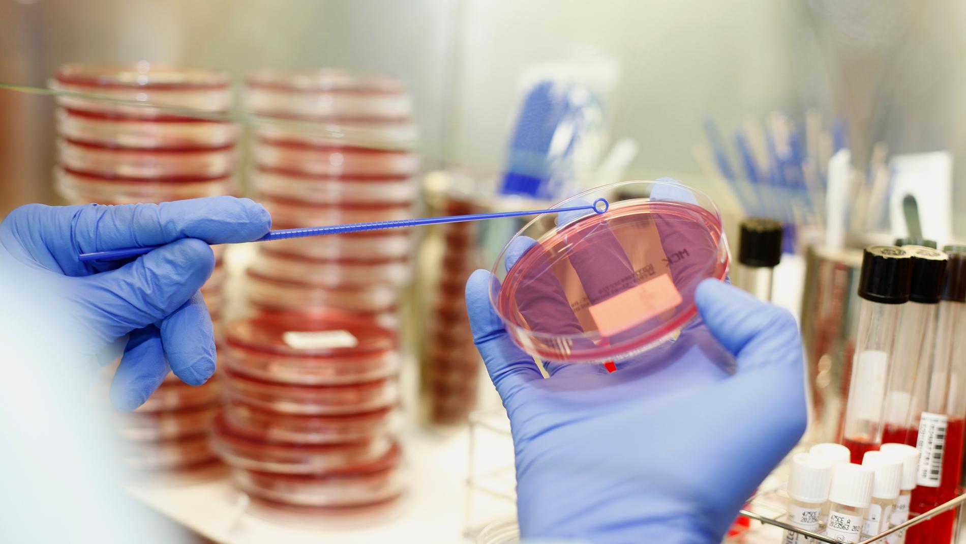 მტკიცებულებაზე დაფუძნებული ანტიმიკრობული მართვა და ლაბორატორიული პრაქტიკა